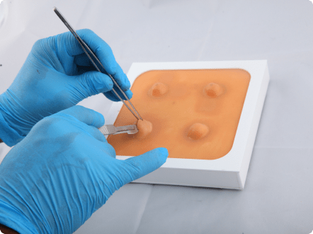 Realistic Cyst & Abscess Removal Trainer for Practice