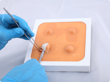 Realistic Cyst & Abscess Removal Trainer for Practice