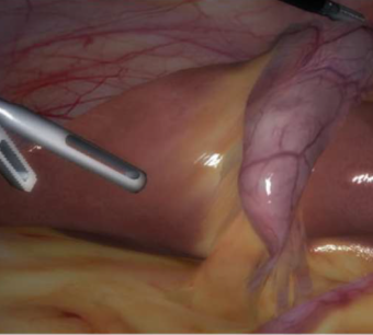 LapVision Hybrid Advanced Laparoscopy Training Simulator