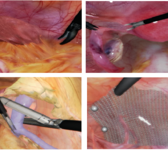 Immersive Anatomies Including