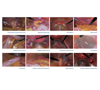 LapVision Hybrid Advanced Laparoscopy Training Simulator