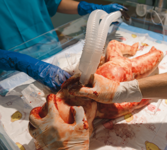 Lusi Lung Simulator, baby lung simulator, neonatal ventilation training, autonomous human lung simulators