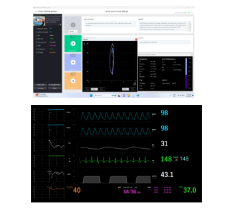 Lusi Lung Simulator, baby lung simulator, neonatal ventilation training, autonomous human lung simulators